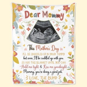 Custom Photo Every Baby Is A Little Miracle - Family Personalized Custom Blanket - Mother's Day, Baby Shower Gift, Gift For First Mom